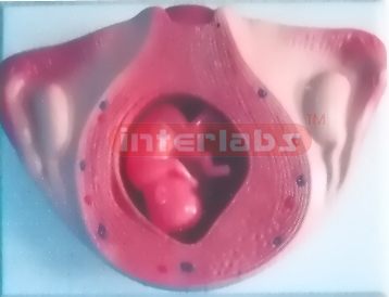 UTERUS WITH EMBRYO (3 MONTH)